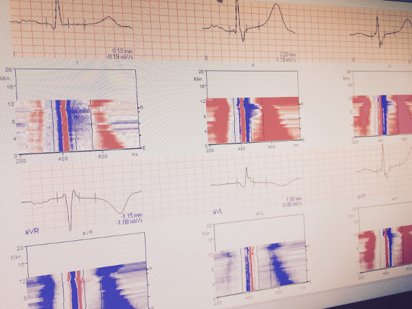 ecocardiografia aviles