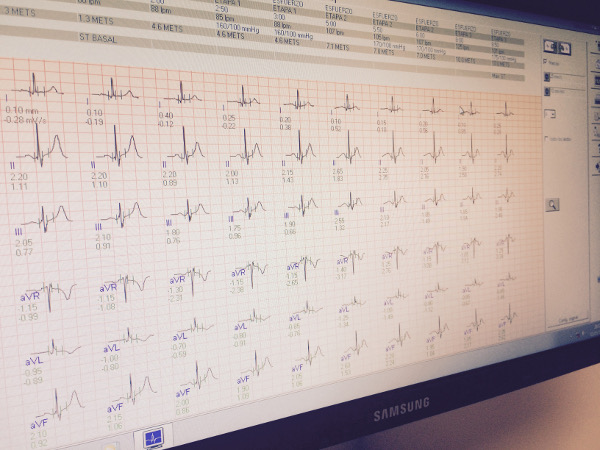 ecocardiografia aviles
